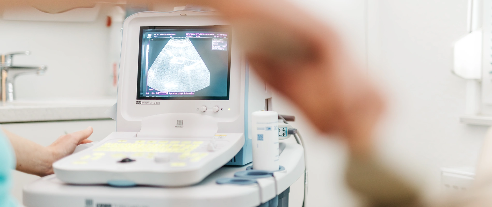 Ultraschallgerät mit Monitor zur medizinischen Sonographie-Untersuchung in der Arztpraxis Ilsede