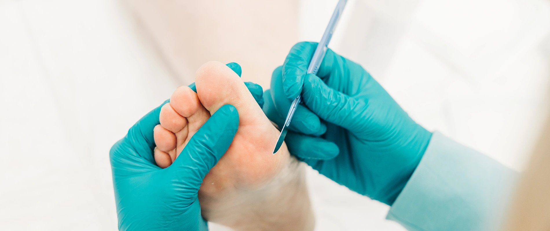 Professionelle diabetische Fußpflege und Untersuchung des Fußes durch medizinisches Fachpersonal mit Handschuhen